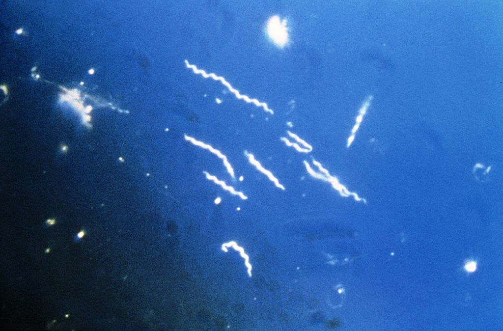 Imagen: Microfotografía de campo oscuro (400 aumentos) que muestra la presencia de la espiroqueta, Borrelia burgdorferi, que es el patógeno causante de la enfermedad de Lyme (Fotografía cortesía de los Centros para el Control y la Prevención de Enfermedades [EUA] a través de Wikimedia Commons)