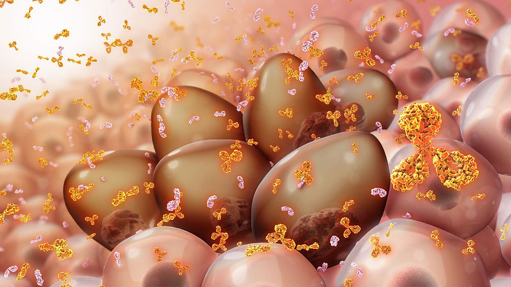 Imagen: Representación de un artista de células de mieloma que producen proteínas monoclonales de diversos tipos (Fotografía cortesía de Wikimedia Commons)