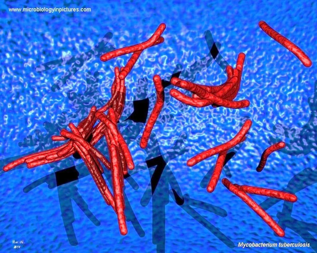 Imagen: Mycobacterium tuberculosos generada por computadora. Coloración ácido-alcohol resistente. Los reactivos utilizados son carbol fucsina, alcohol ácido y contratinción con azul de metileno. Los bacilos acidorresistentes se tiñen de rojo y el fondo es azul (Fotografía cortesía de microbiologyinpictures).