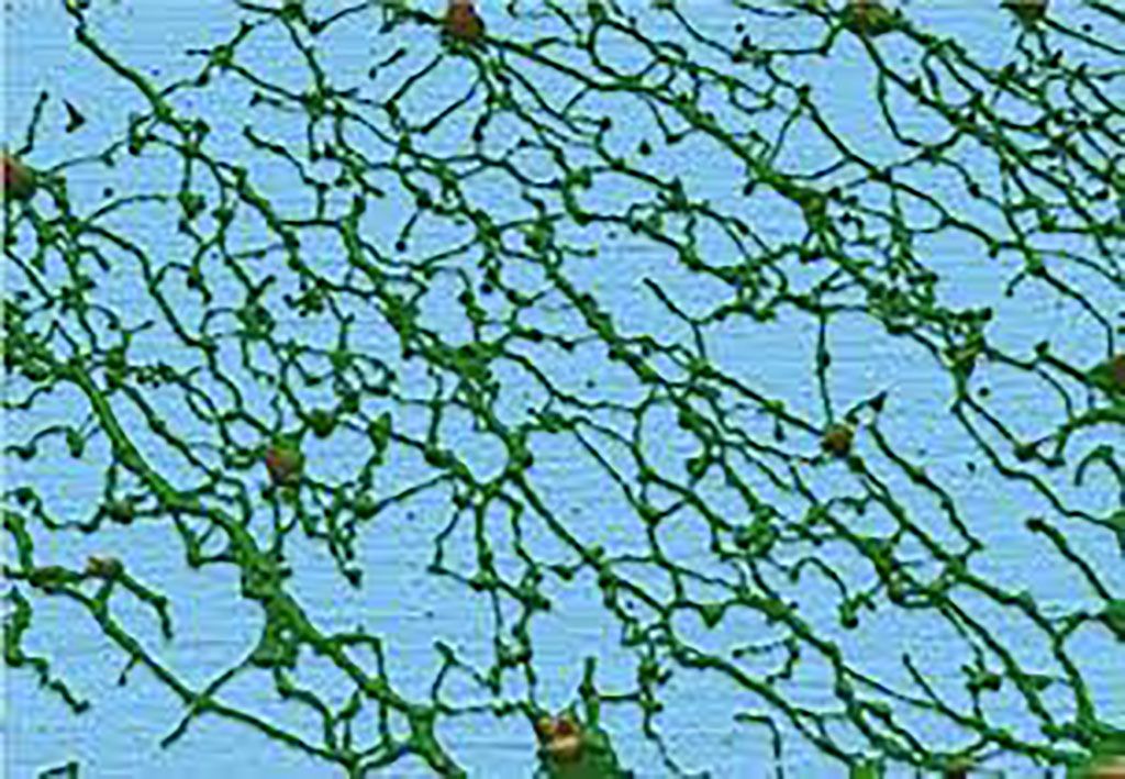 Imagen: Proteínas de mucina (verde) en una muestra de moco de las vías respiratorias (Fotografía cortesía de la Universidad de Carolina del Norte)