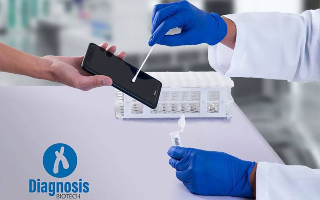 Imagen: La prueba no invasiva y de bajo costo utiliza frotis de los teléfonos para detectar la COVID-19 con exactitud (Fotografía cortesía de Diagnosis Biotech)