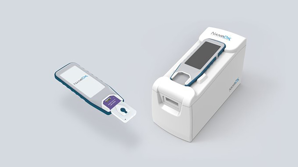 Imagen: La prueba COVID-19 de dos minutos utiliza tecnología de nanosensores para detectar la presencia de infección por SARS-CoV-2 en la sangre en los POC (Fotografía cortesía de NanoDx, Inc.)
