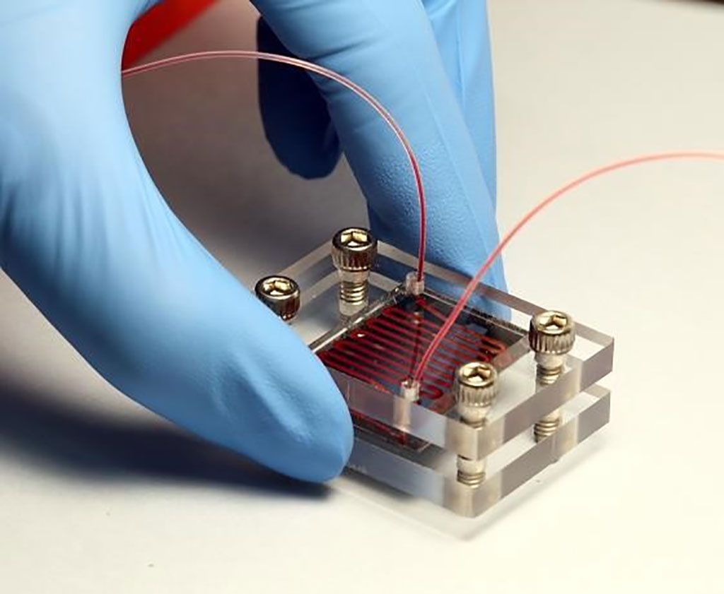 Imagen: El dispositivo NanoVelcro ha sido utilizado para detectar trastornos del espectro de placenta accreta (PAS) (Fotografía cortesía de la Universidad de California, Los Ángeles)