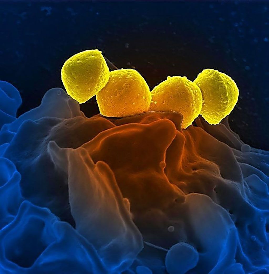 Imagen: La ilustración de microscopio electrónico de barrido (SEM), coloreada digitalmente, muestra cuatro Streptococcus del grupo A (EGA) de color amarillo, Streptococcus pyogenes (Fotografía cortesía del Instituto Nacional de Alergias y Enfermedades Infecciosas)