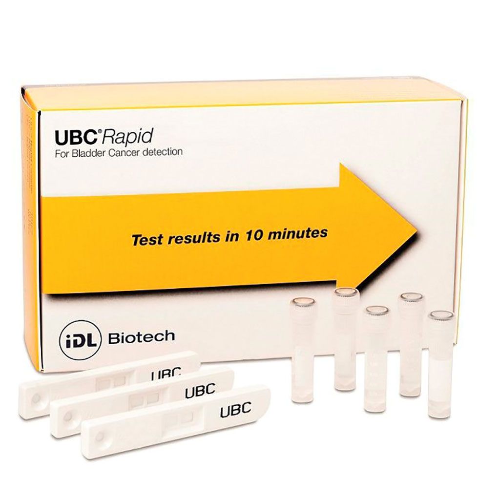 Imagen: El UBC Rapid es una prueba cualitativa para detectar los fragmentos de citoqueratina 8 y 18 en la orina para la detección del cáncer de vejiga (Fotografía cortesía de IDL Biotech)