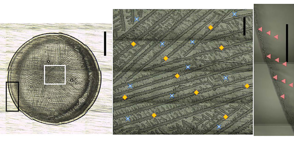 Imagen: Modelo de aprendizaje automático (Fotografía cortesía de Ember et al., doi 10.1117/1.JBO.27.2.025002)