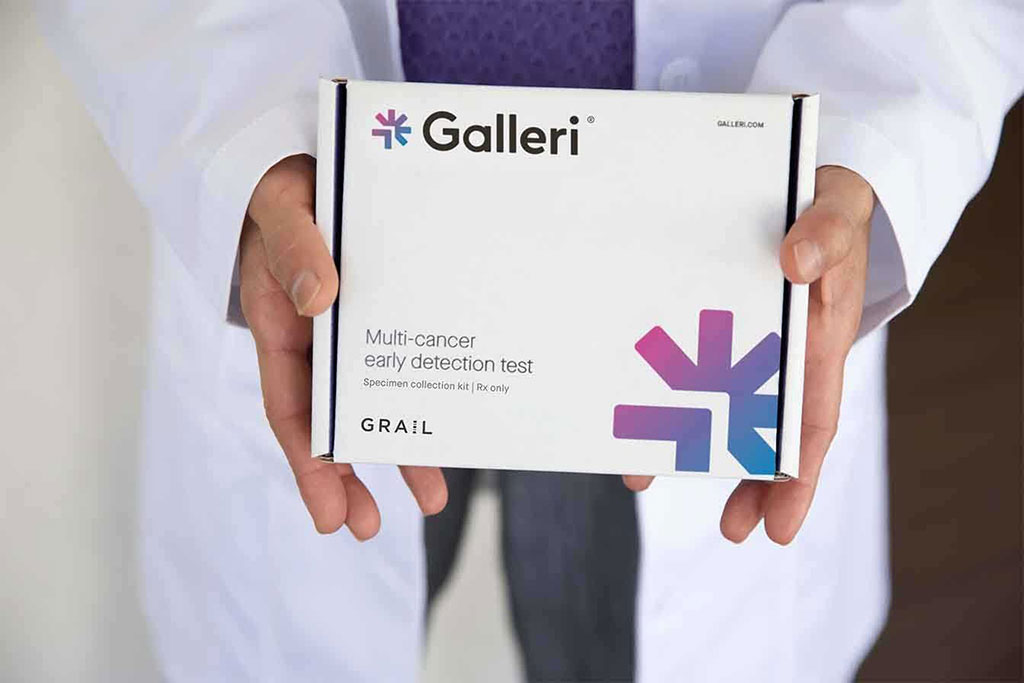 Imagen: Prueba para múltiples cánceres Galleri (Fotografía cortesía de GRAIL, LLC)