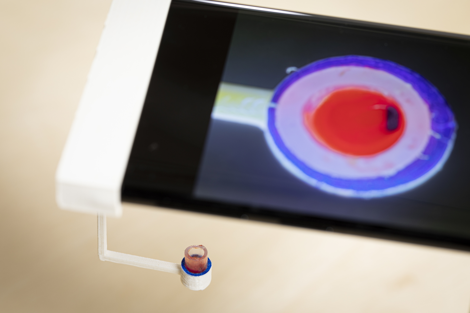 Imagen: Una nueva prueba de coagulación de la sangre que usa solo una gota de sangre y un teléfono inteligente con un accesorio de plástico que sostiene una taza pequeña debajo de la cámara del teléfono (Fotografía cortesía de Mark Stone/Universidad de Washington).
