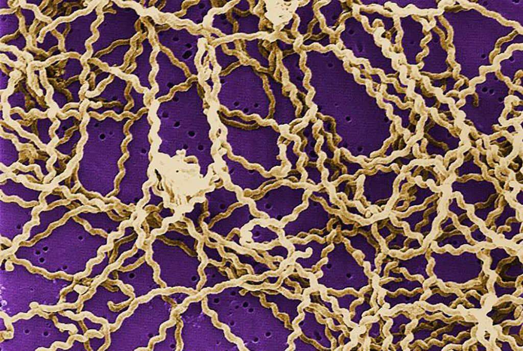 Imagen: Esta fotografía de microscopía electrónica de barrido (SEM), coloreada digitalmente, muestra una serie de bacterias de Leptospira sp. encima de un filtro de policarbonato de 0,1 µm (Fotografía cortesía de Janice Haney Carr/CDC)
