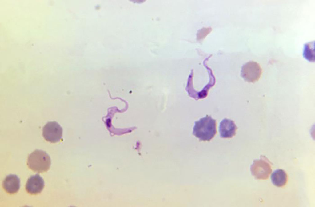 Imagen: La fotomicrografía de una muestra de sangre reveló la presencia de dos parásitos flagelados de Trypanosoma cruzi (Fotografía cortesía de la Dra. Mae Melvin/CDC)