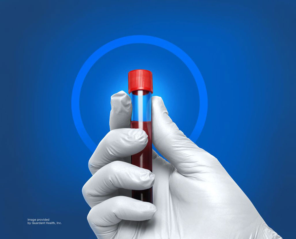 Imagen: los nuevos datos muestran que los análisis de sangre son altamente precisos en la detección de múltiples cánceres (Fotografía cortesía de Guardant Health)