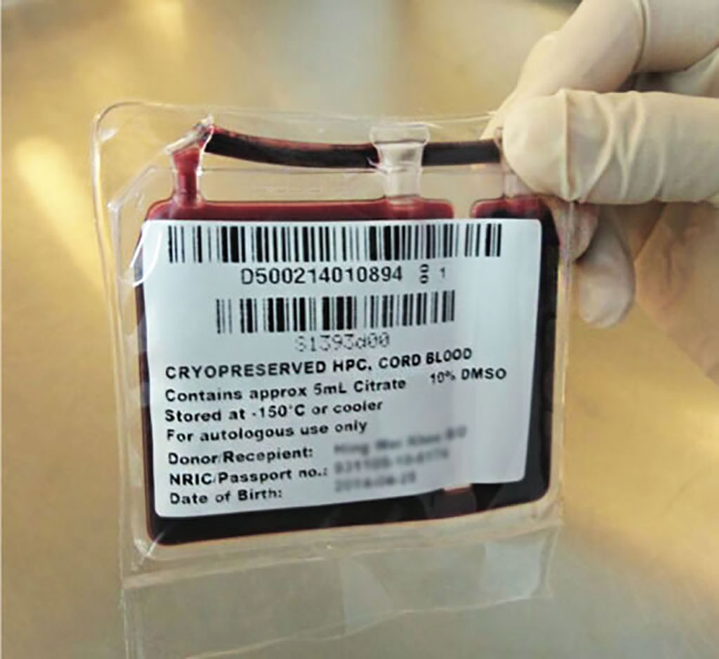 Imagen: La sangre del cordón umbilical ha aumentado el acceso a terapias potencialmente curativas para pacientes con trastornos potencialmente mortales de la médula ósea y el sistema inmune (Fotografía cortesía de Cellsafe Biotech Group)