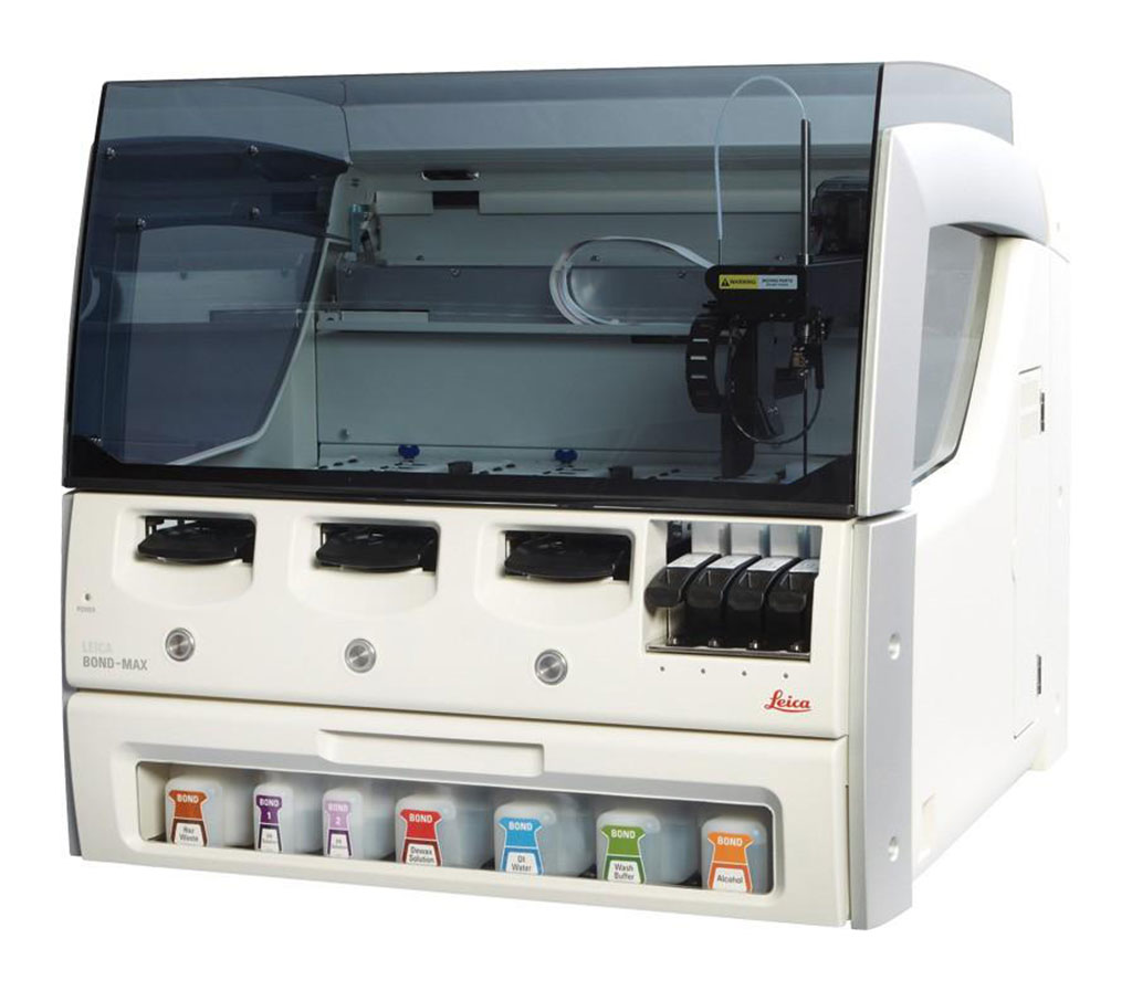 Imagen: Sistema de coloración IHC e ISH, completamente automatizado, BOND-MAX (Fotografía cortesía de LeicaBiosystems)
