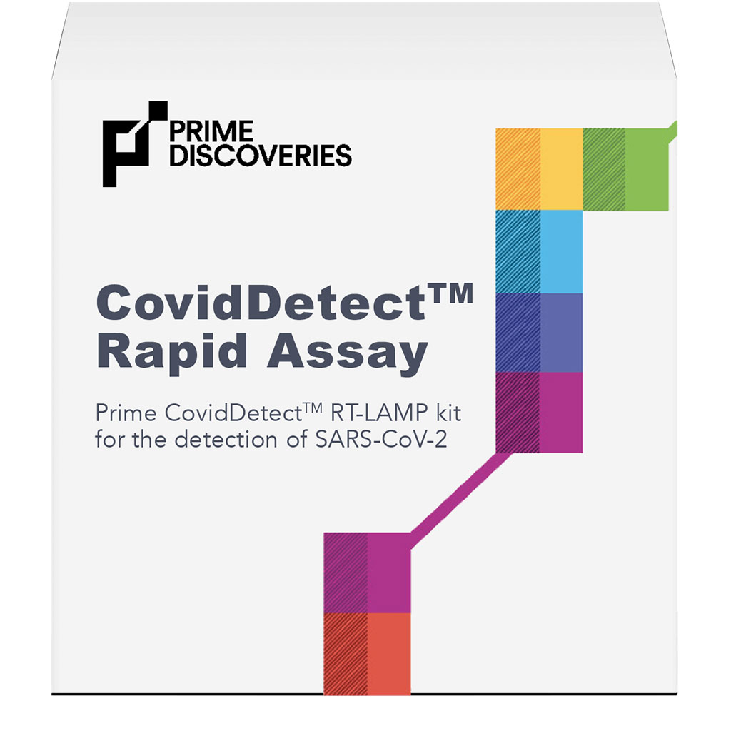Imagen: Ensayo de detección basado en CovidDetect RT-LAMP para todas las cepas conocidas de SARS-CoV-2 (Fotografía cortesía de Prime Discoveries)