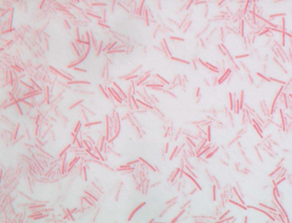 Imagen: Coloración de Gram de la bacteria Negativibacillus massiliensis aislada de una muestra de colon izquierdo humano (Fotografía cortesía de la Universidad Aix Marseille)