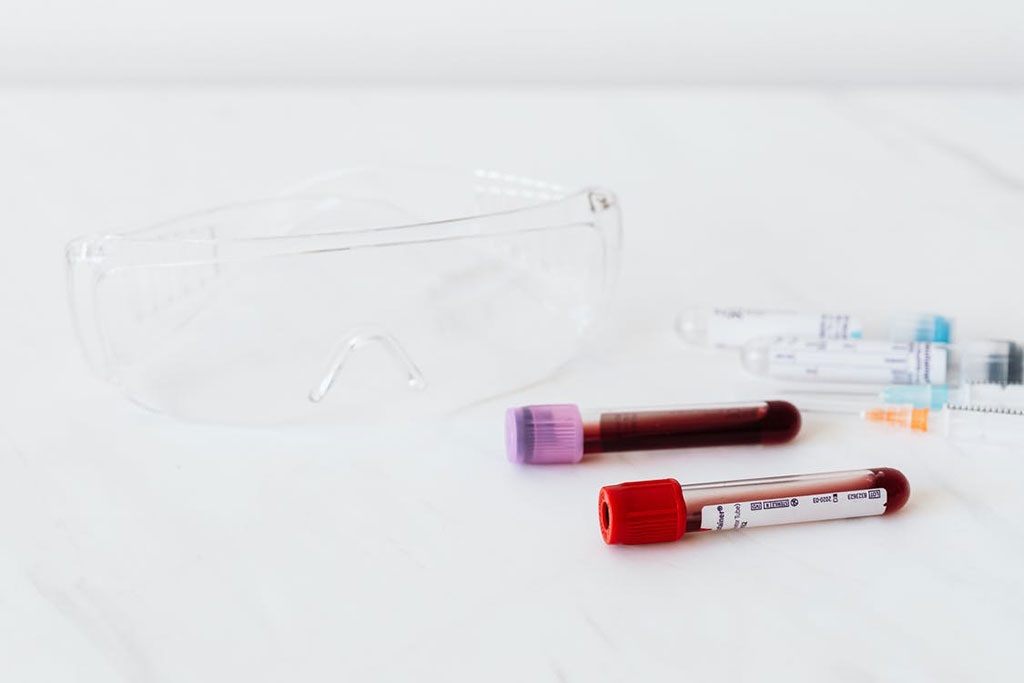 Imagen: Nuevo análisis de sangre  hecho por MG podría ayudar a diagnosticar el cáncer de ovario más rápido y con mayor precisión (Fotografía cortesía de Pexels)