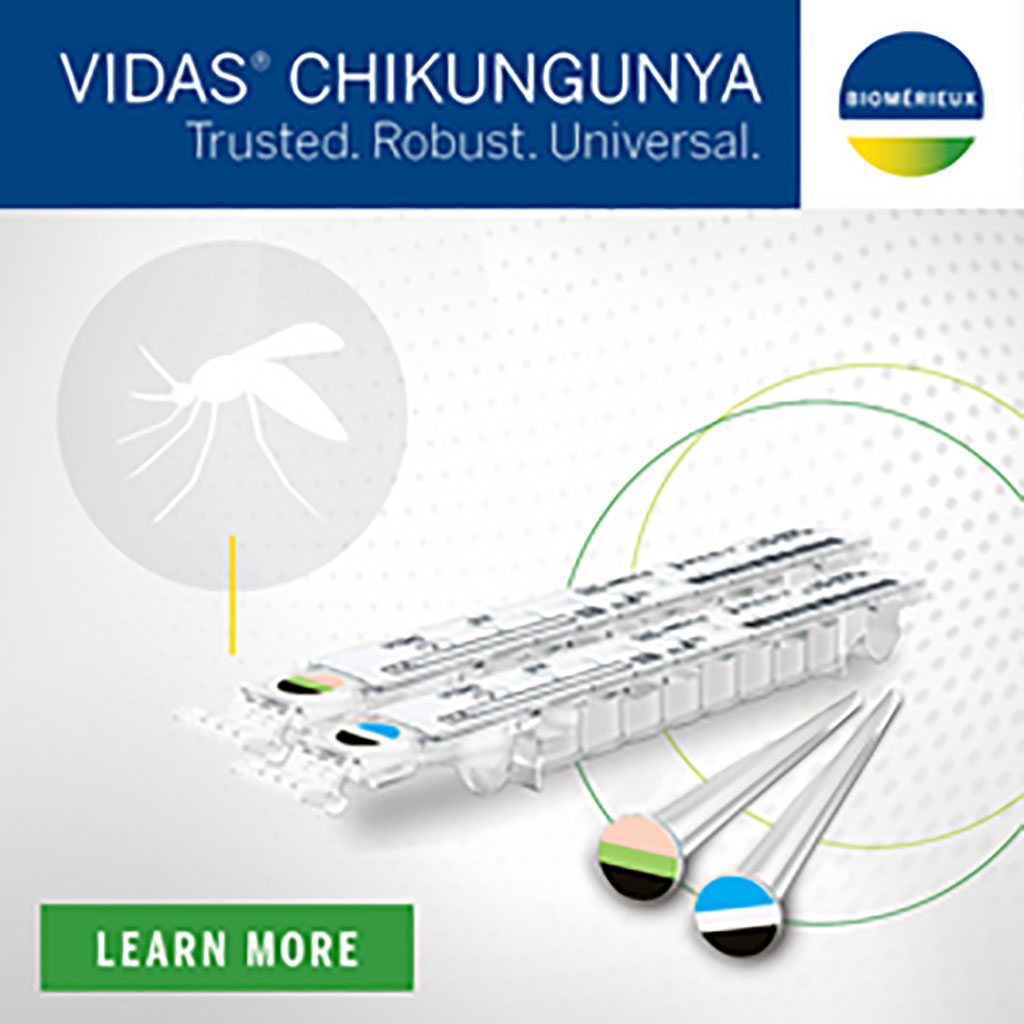 Imagen: VIDAS Anti-CHIKUNGUNYA IgM y Anti-CHIKUNGUNYA IgG (Fotografía cortesía de bioMérieux)
