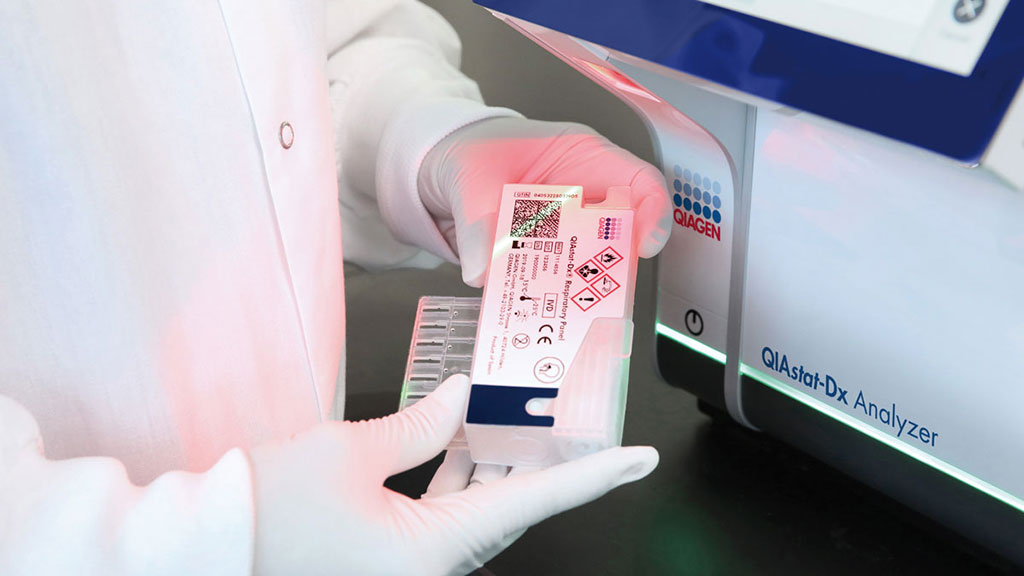 Imagen: La plataforma de pruebas síndrómicas QIAstat-Dx Rise proporciona pruebas de patógenos automatizadas y completas (Fotografía cortesía de QIAGEN)