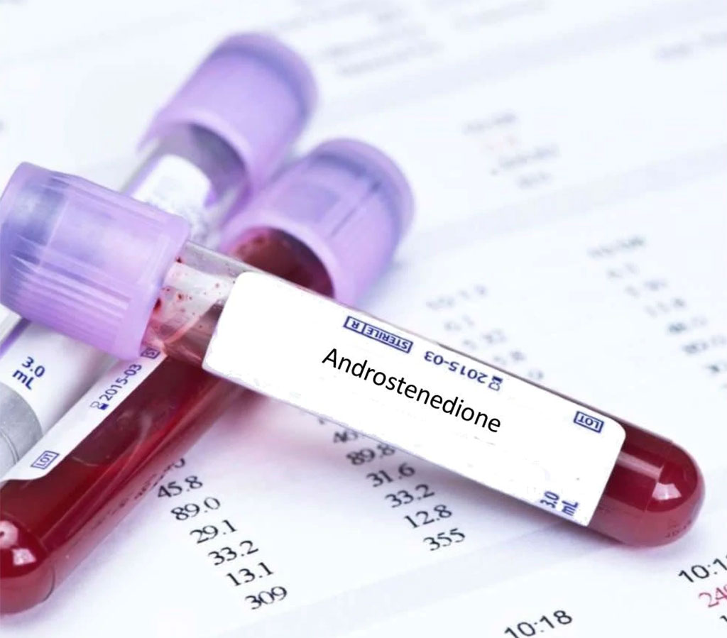 Imagen: El nuevo ensayo de Elecsys para androstenediona ha sido comparado y evaluado (Fotografía cortesía de Blood Tests London)
