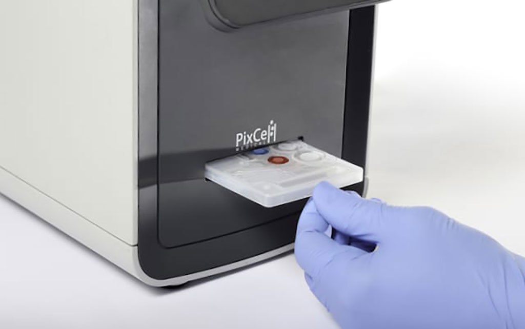 Imagen: El analizador de pruebas de sangre para el POC HemoScreen hace que las pruebas sean simples y accesibles en cualquier lugar (Fotografía cortesía de PixCell Medical)