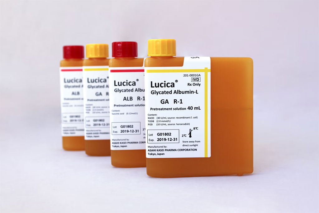 Imagen: El ensayo Lucica Glycated Albumin-L es una prueba de diagnóstico nueva para medir la AG. La prueba se basa en un método enzimático que utiliza reactivos líquidos que no requieren preparación (Fotografía cortesía de Asahi Kasei Pharma Corporation)
