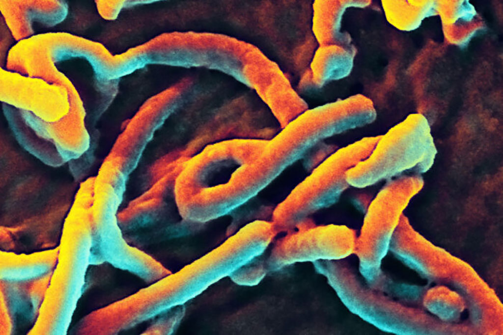 Imagen: Imagen microscópica electrónica de barrido colorizado que representa partículas de virus del Ébola incipientes desde la superficie de una célula (Fotografía cortesía de NIAID)