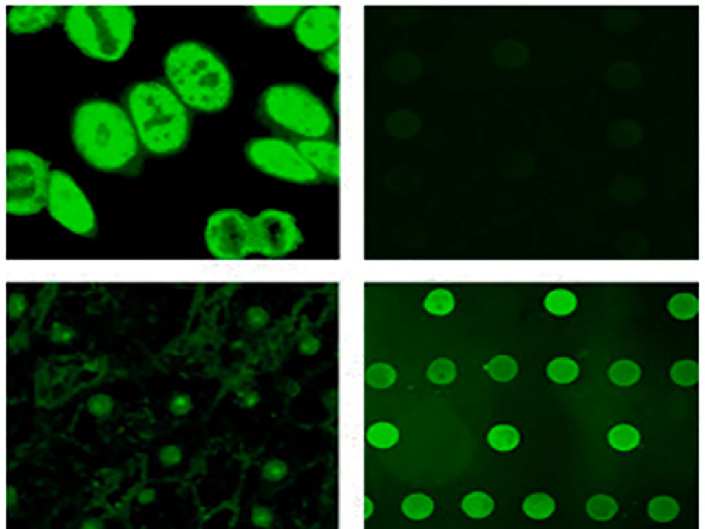 Imagen: El estándar de oro para la determinación de anticuerpos antinucleares (ANA) es la prueba de inmunofluorescencia indirecta (IIFT) con células epiteliales humanas (HEp-2), que es conocida por su alta sensibilidad y especificidad (Fotografía cortesía de Euroimmun)
