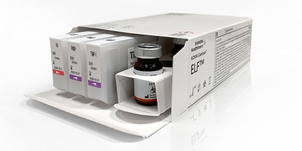 Imagen: La prueba ELF se ha recomendado fuertemente en las pautas de 2022 de la AACE para EHGNA (Fotografía cortesía de Siemens Healthineers)