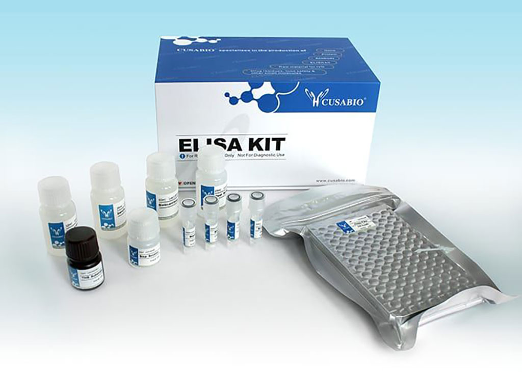 Imagen: El kit ELISA de irisina humana, Cusabio, predice el desarrollo de diabetes gestacional (Fotografía cortesía de American Research Products, Inc.)