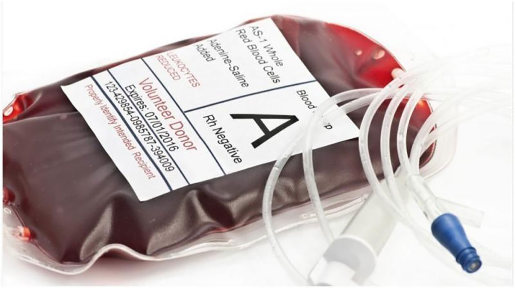 Imagen: El almacenamiento de glóbulos rojos en PAGGGM alcalino mejora el metabolismo, pero no tiene efecto en la recuperación después de la transfusión (Fotografía cortesía de openPR)