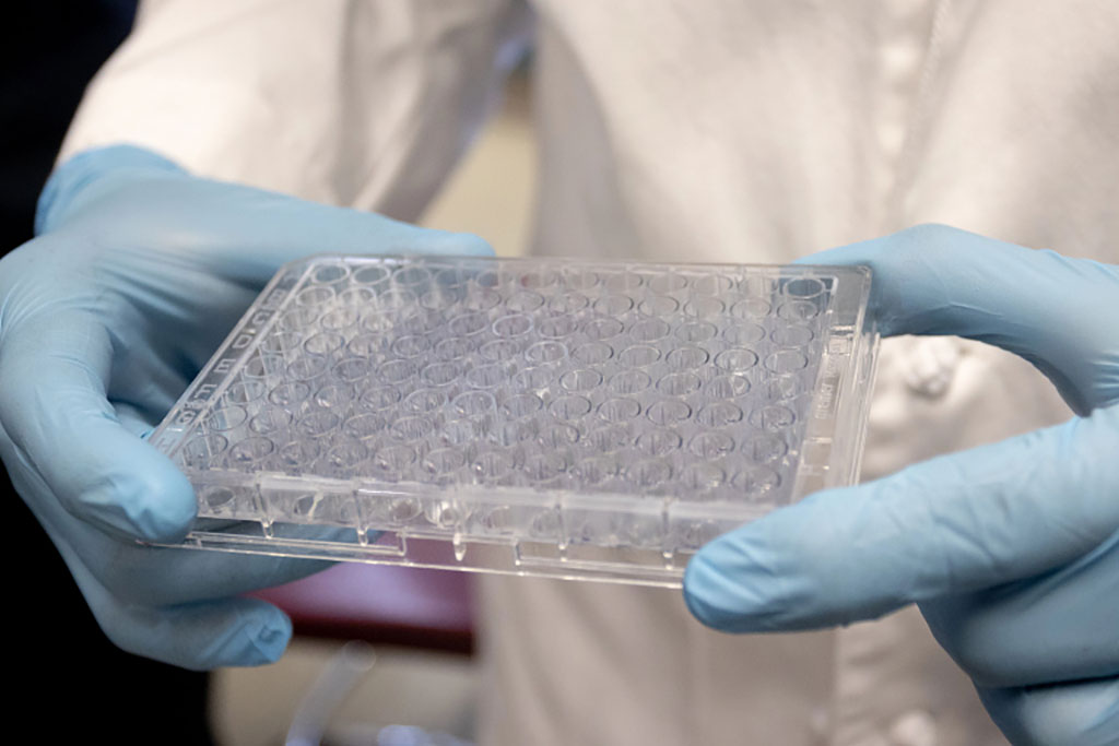 Imagen: El biosensor puede analizar hasta 96 muestras en varias horas con una sensibilidad sin precedentes (Fotografía cortesía de la Universidad de Indiana)