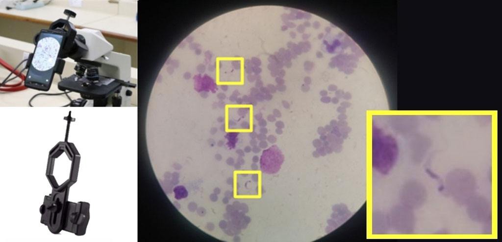 Imagen: El algoritmo identifica el protozoo Trypanosoma Cruzi fotos de muestras de sangre tomadas con teléfono inteligente (Fotografí cortesía de la Universidad de São Paulo)