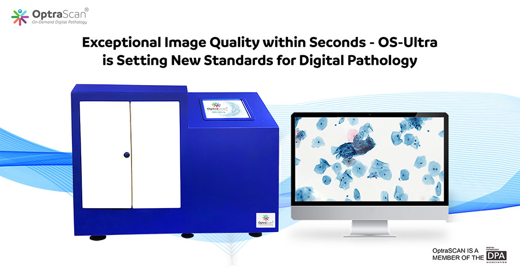Imagen: Sistema de patología digital de alto rendimiento OS-Ultra recibió la marca CE-IVDR (Fotografía cortesía de OptraSCAN)