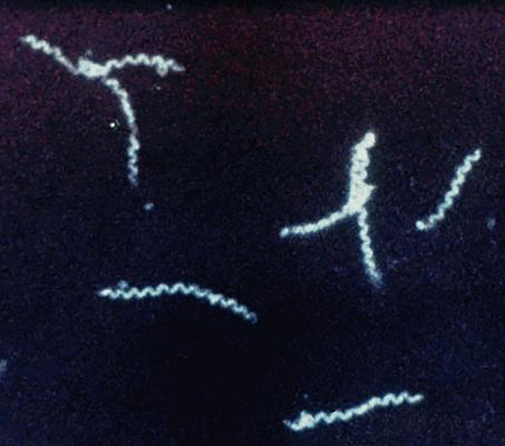 Imagen: Microfotografía de espiroquetas de la bacteria, Treponema pallidum, que exhibieron su característica forma de sacacorchos utilizando la técnica de visualización de campo oscuro (Fotografía cortesía de Louisa Lu, MD)