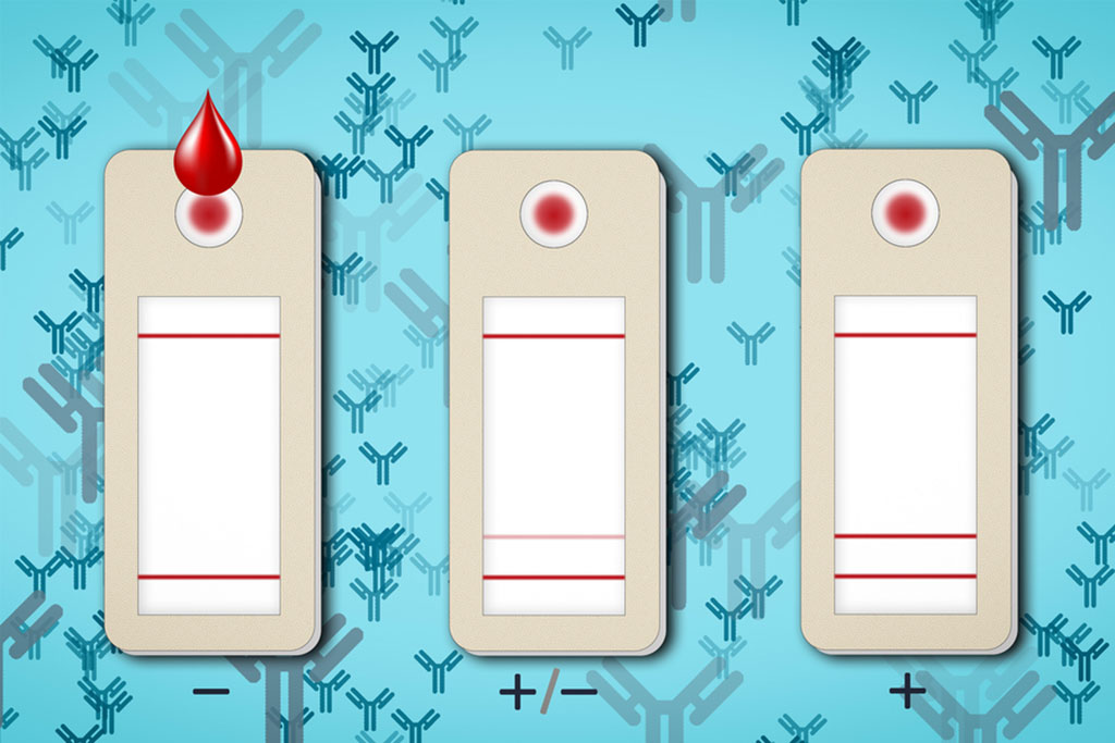 Imagen: La prueba de papel mide el nivel de anticuerpos neutralizantes en una muestra de sangre (Fotografía cortesía del MIT)
