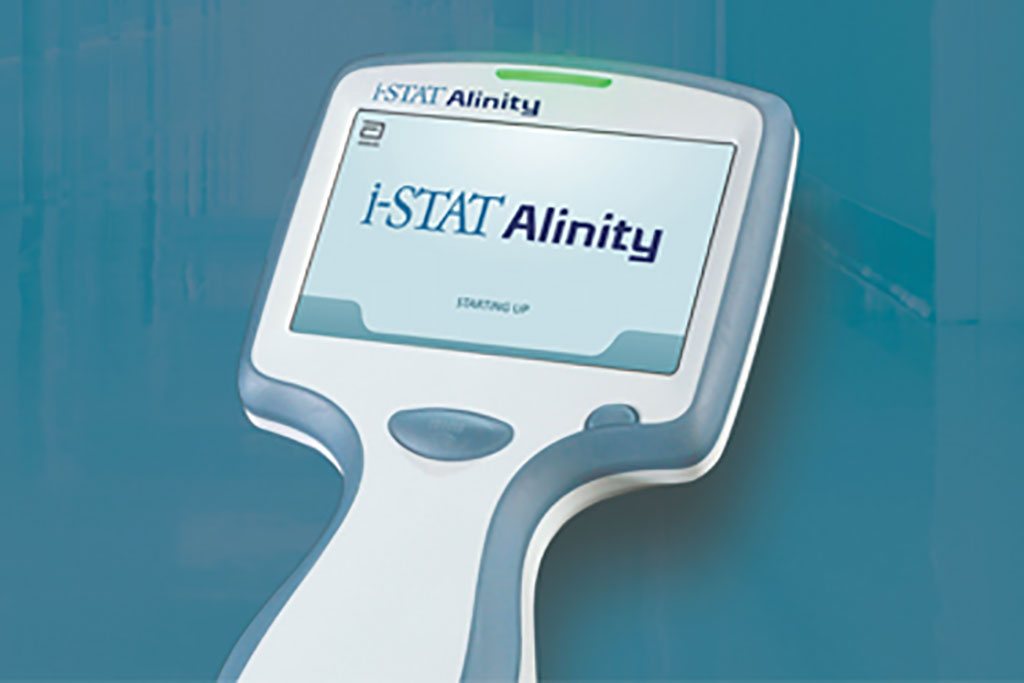 Imagen: El i-STAT Alinity es un analizador de sangre portátil fácil de usar que ofrece resultados de pruebas de diagnóstico de calidad de laboratorio en tiempo real (Fotografía cortesía de Abbott)