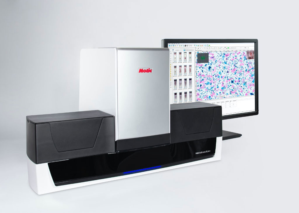 Imagen: El revolucionario MoticEasyScan New Infinity permite a los laboratorios escanear más de 1.000 portaobjetos por semana (Fotografía cortesía de Motic Digital Pathology)