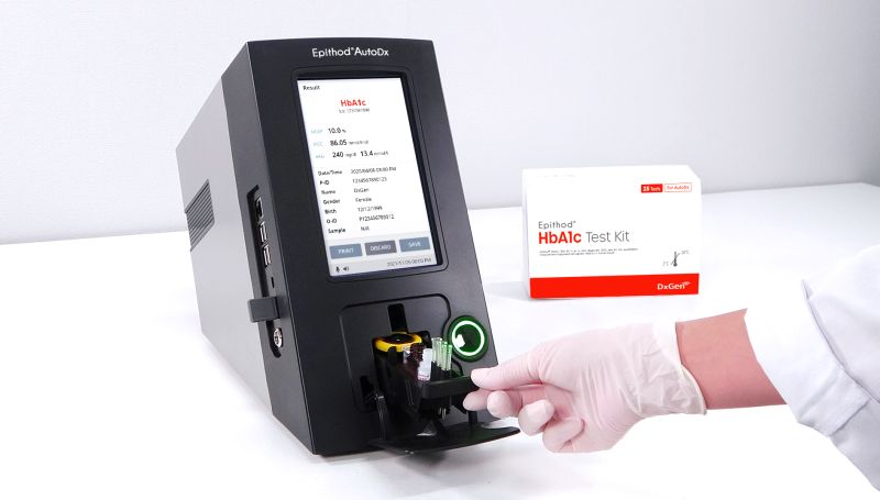 Imagen: EpithodAutoDx es un analizador POC totalmente automático que mide un perfil integral de pruebas de diabetes (Fotografía cortesía de DxGEN Corp.)