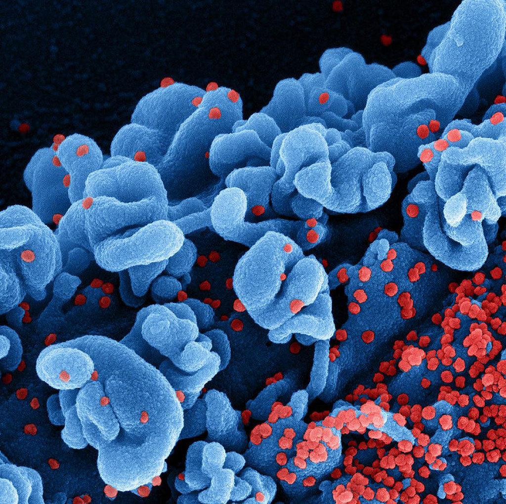 Imagen: micrografía electrónica de barrido a color de una célula infectada con la cepa ómicron del SARS-CoV-2 (Fotografía cortesía de los NIH)