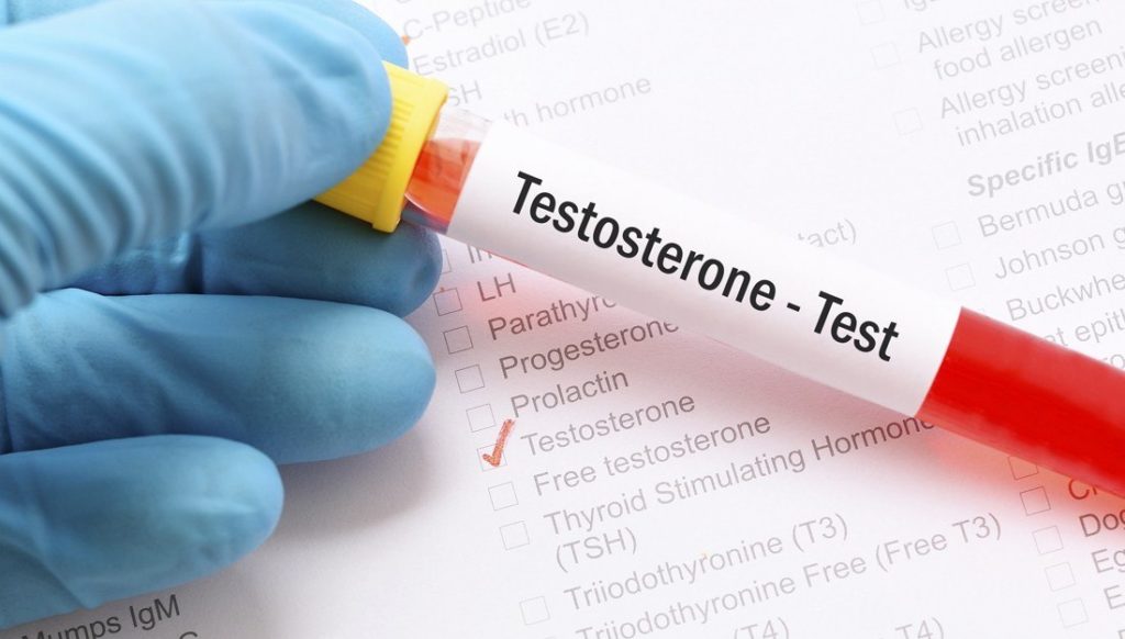 Imagen: Muestra de sangre para la prueba de la hormona testosterona: los niveles bajos de testosterona podrían indicar una COVID-19 más grave en los hombres (Fotografía cortesía de Rae Lynn Mitchell, MA)