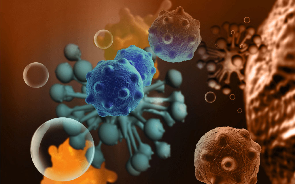 Imagen: Un nuevo estudio ha mostrado el vínculo entre las bacterias del microbioma y la detección temprana del cáncer colorrectal (Fotografía cortesía de Universal Diagnostics)