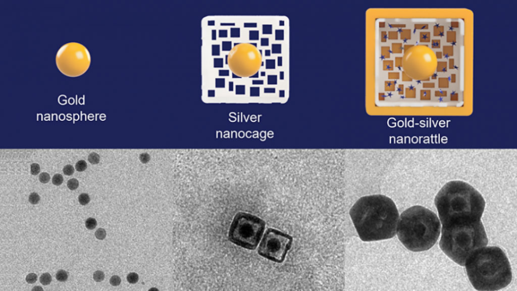 Imagen: La nueva forma de nanopartículas puede mejorar en gran medida las señales de múltiples biomarcadores separados a la vez (Fotografía cortesía de la Universidad de Duke)