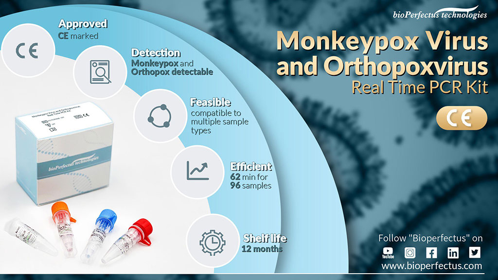 Imagen: Kit de PCR en tiempo real para el virus de la viruela del mono y ortopoxvirus (Fotografía cortesía de Bioperfectus)