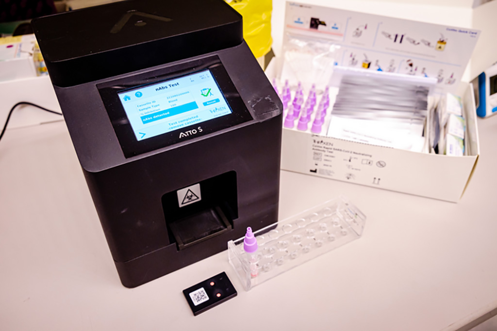 Imagen: kits de análisis de anticuerpos contra la COVID-19 (derecha) y el lector digital (izquierda en negro) (Fotografía cortesía de NTU Singapur)