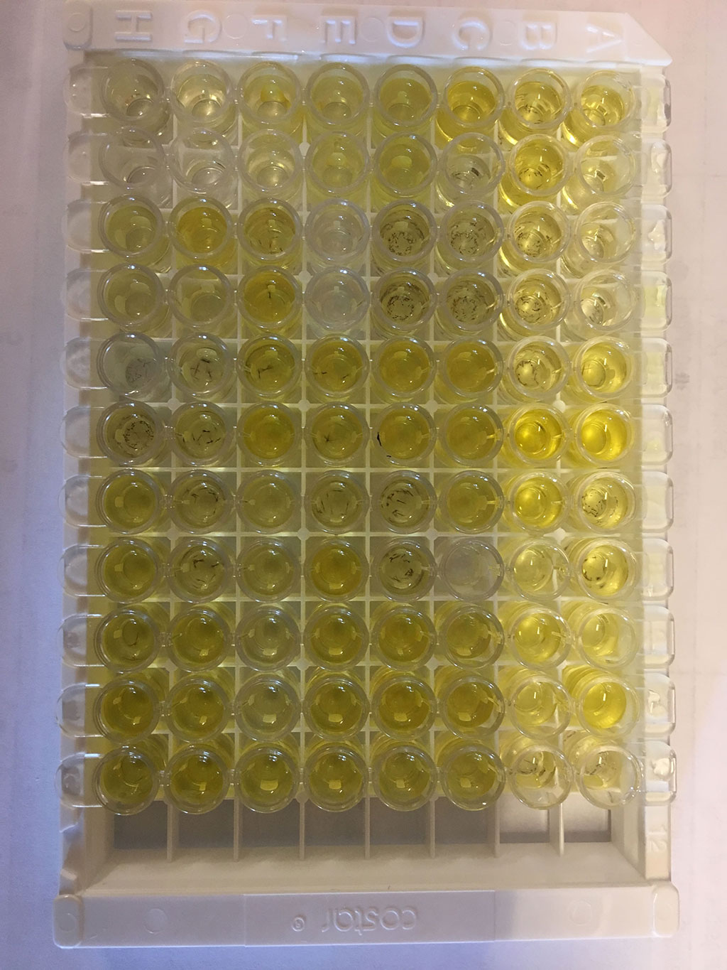 Imagen: Kit Duo Set ELISA para la determinación de Lipocalina asociada a gelatinasa de neutrófilos (NGAL) (Fotografía cortesía de R&D Systems)