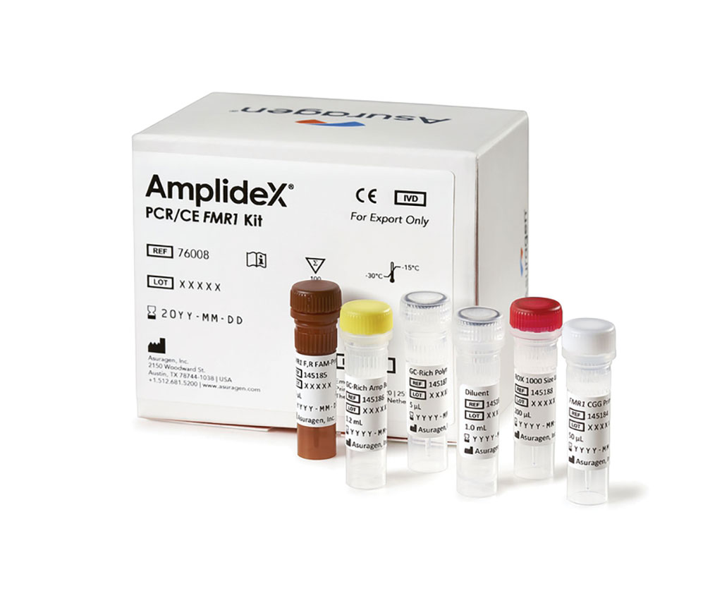Imagen: Los reactivos AmplideX PCR/CE FMR1 son para la detección de repeticiones CGG en el gen del retraso mental X frágil (FMR1). Estos reactivos proporcionan un enfoque solo de PCR basado en el diseño de PCR cebado con triplete repetido (TP-PCR) para amplificar y detectar de manera confiable todos los alelos, incluidas las mutaciones completas (Fotografía cortesía de Asuragen)