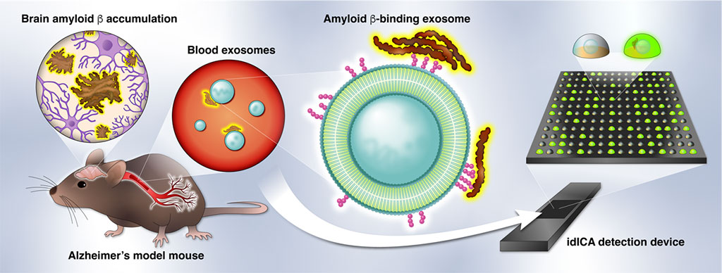 Imagen: Concepto para la detección digital de exosomas de unión a β amiloide en la sangre de modelos de ratón de enfermedad de Alzheimer (Fotografía cortesía de la Universidad de Hokkaido)