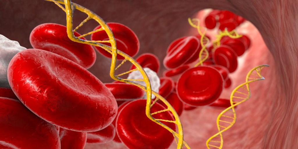 Imagen: Fragmentos de ácidos nucleicos libres de células (ADN y ARN) en sangre humana (Fotografía cortesía de www.123rf.com)