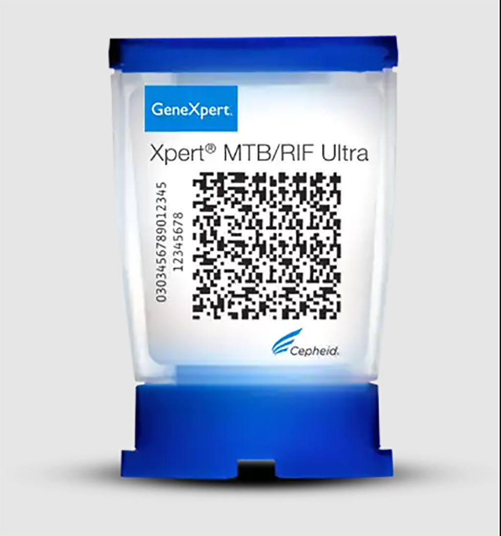 Imagen: Xpert MTB/RIF Ultra detecta casos de TB sensibles y resistentes a los medicamentos en menos de 80 minutos (Fotografía cortesía de Cepheid)