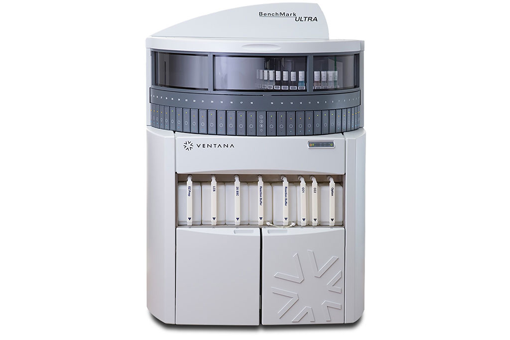 Imagen: El sistema BenchMark ULTRA es el sistema totalmente automatizado de coloración de láminas de hibridación in situ e inmunohistoquímica, más innovador de Roche Tissue Diagnostics (Fotografía cortesía del Grupo Roche)